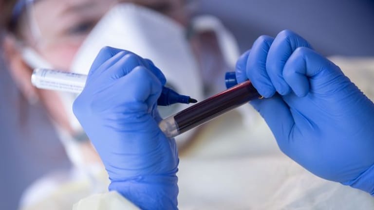 Eine Mitarbeiterin des Robert Koch-Instituts beschriftet eine Blutprobe für einen Antikörpertest (Symbol).