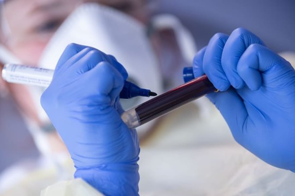 Eine Mitarbeiterin des Robert Koch-Instituts beschriftet eine Blutprobe für einen Antikörpertest (Symbol).