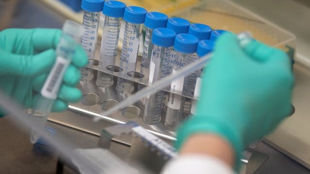 Eine Mitarbeiterin des Landesgesundheitsamts Baden-Württemberg pipettiert Proben. Eine Mitarbeiterin des Landesgesundheitsamts Baden-Württemberg pipettiert Proben.