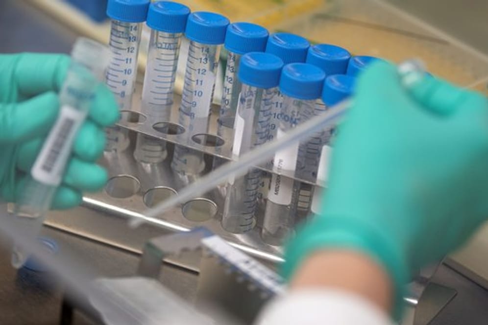 Eine Mitarbeiterin des Landesgesundheitsamts Baden-Württemberg pipettiert Proben.