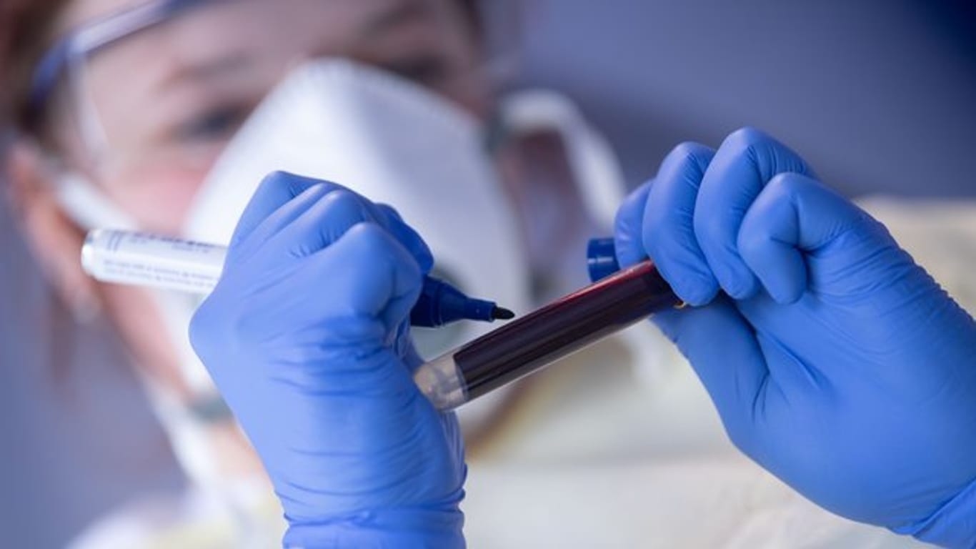 Eine Mitarbeiterin des Robert Koch-Instituts beschriftet eine Blutprobe für einen Antikörpertest.