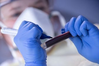 Eine Mitarbeiterin des Robert Koch-Instituts beschriftet eine Blutprobe für einen Antikörpertest.