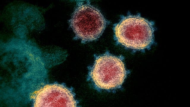 Anhand von Mutationen lässt sich nachvollziehen, wie sich das Virus SARS-CoV-2 geografisch ausbreitet. Anhand von Mutationen lässt sich nachvollziehen, wie sich das Virus SARS-CoV-2 geografisch ausbreitet.