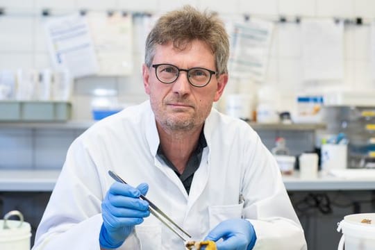 Hans Bösmüller im Labor in der Pathologie der Uniklinik Tübingen: Forschungen der Universitätsklinik Tübingen weisen auf eine Überreaktion des Immunsystems als Ursache für besonders schwere Covid-19-Erkrankungen hin.