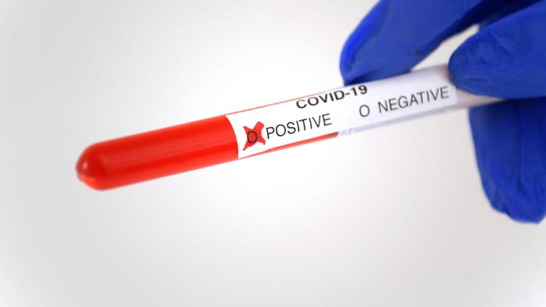 Corona-Test: Weltweit sind nun über 10 Millionen Menschen an Covid-19 erkrankt (Symbolbild).