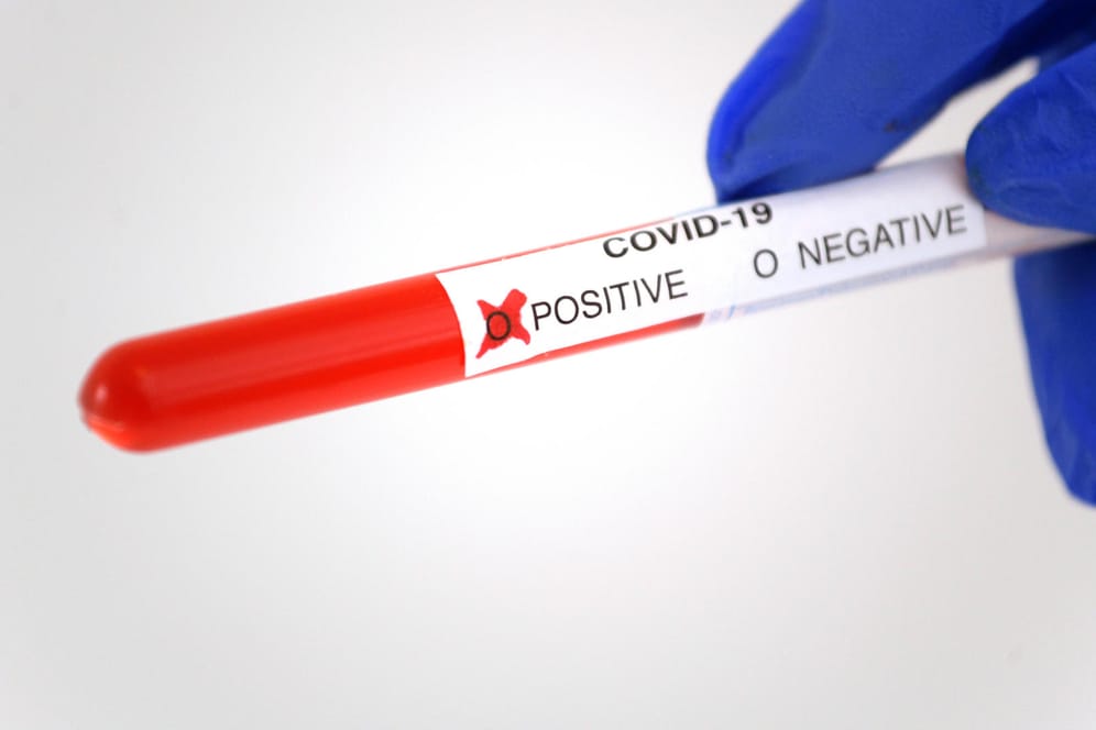 Corona-Test: Weltweit sind nun über 10 Millionen Menschen an Covid-19 erkrankt (Symbolbild).
