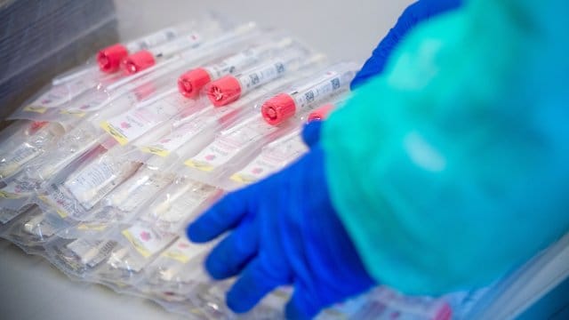 In der kommenden Saisonvorbereitung sollen die Bundesliga-Spieler nur einmal die Woche auf das Coronavirus getestet werden.