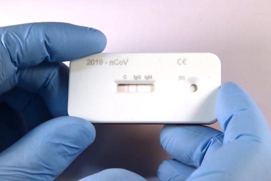 Ein Wissenschaftler zeigt einen Corona-Schnelltest