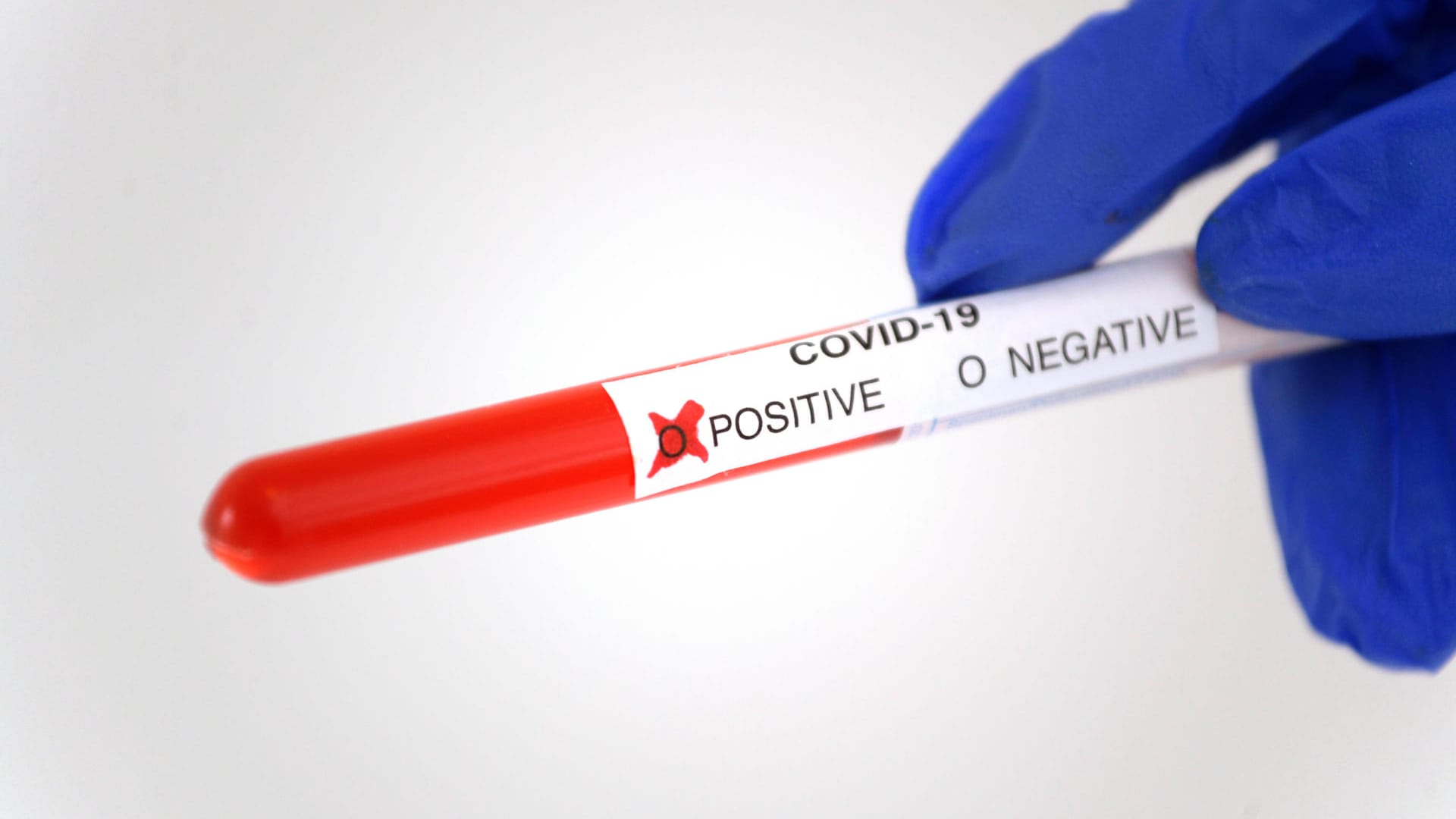Eine Hand hält einen positiven Corona-Test (Symbolbild): In Wolfsburg unterstützen Soldaten nun das Gesundheitsamt. Eine Hand hält einen positiven Corona-Test (Symbolbild): In Wolfsburg unterstützen Soldaten nun das Gesundheitsamt.