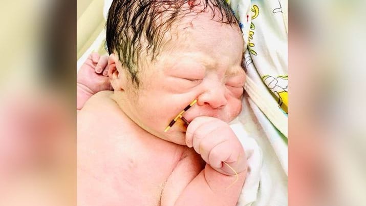 Baby mit Spirale in der Hand: Diese Fotos aus einem Krankenhaus in Vietnam sind ein Internet-Hit.