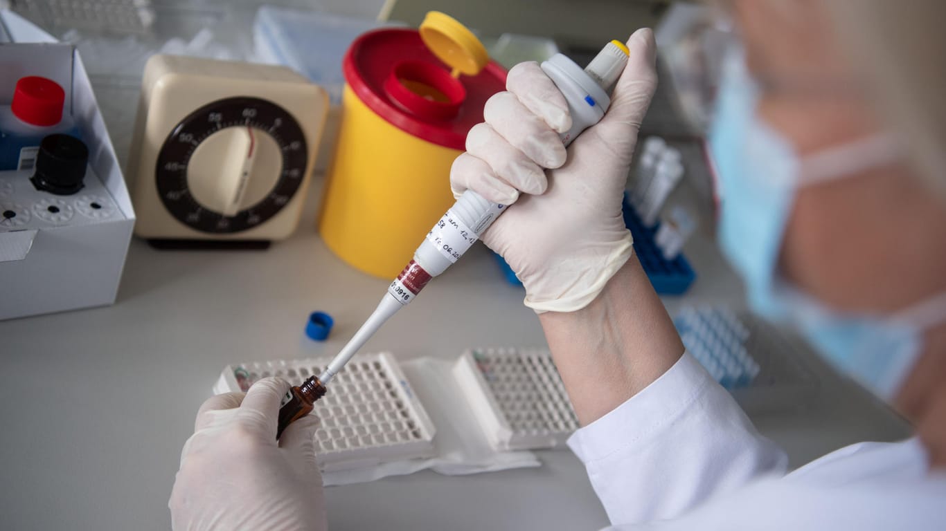 Blutproben-Tests auf Antikörper: Die Welt forscht fieberhaft nach einem Impfstoff.