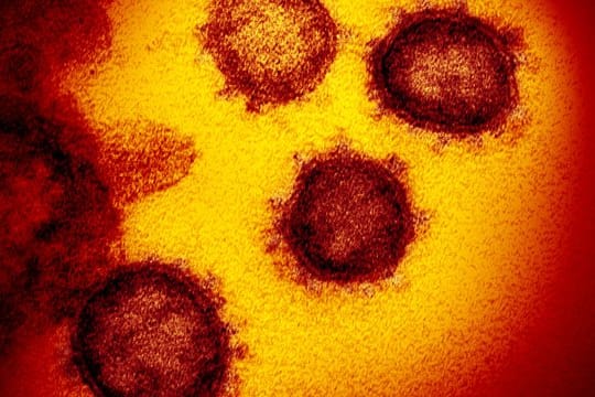 Coronavirus