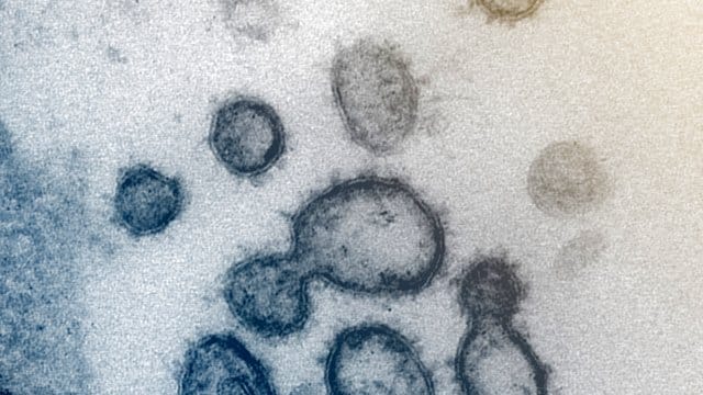 Coronavirus