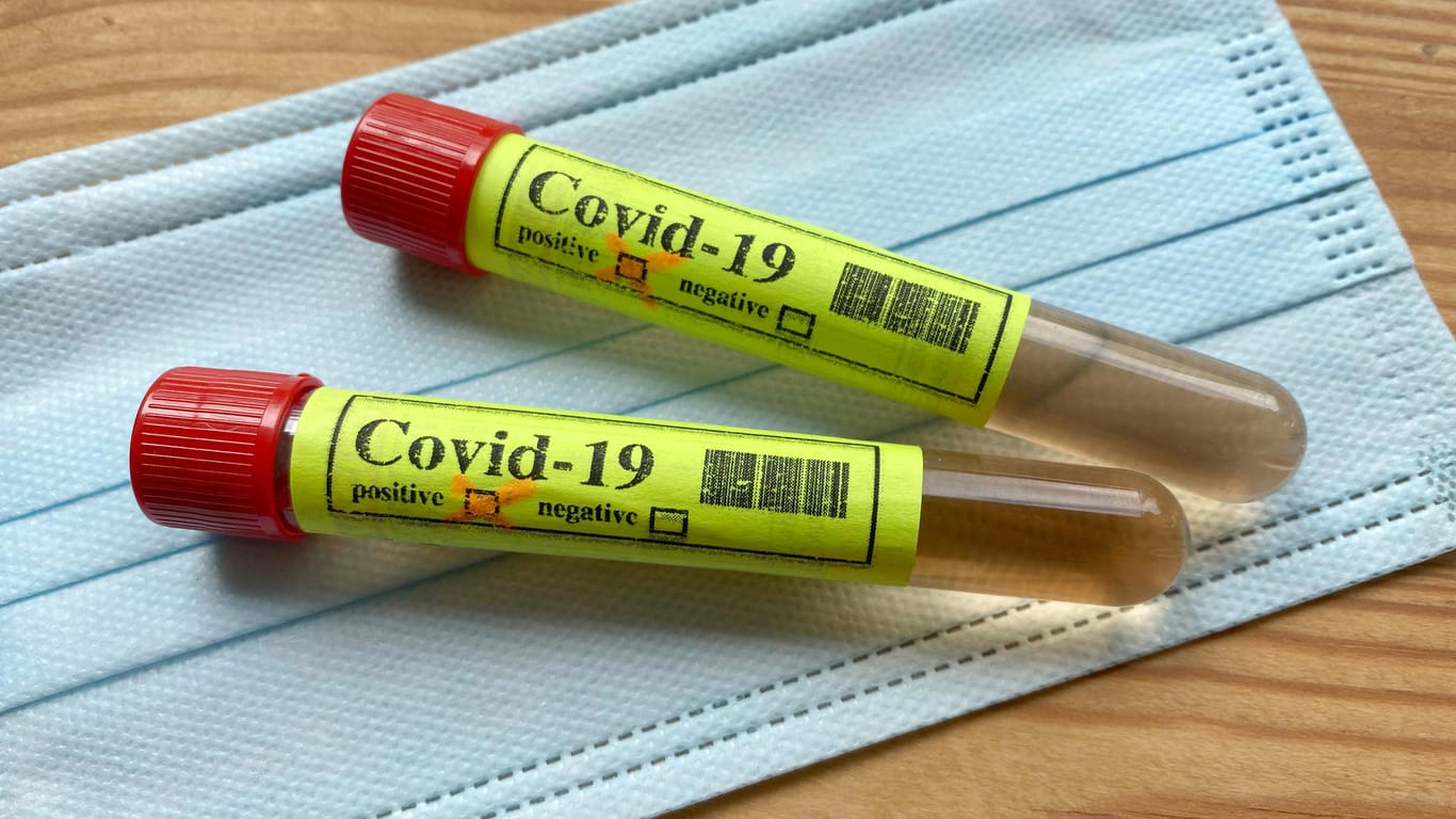 Testampullen liegen auf einer Schutzmaske: In Kiel sollen weitere Beschäftigte eines Imbisses auf das Coronavirus getestet werden.