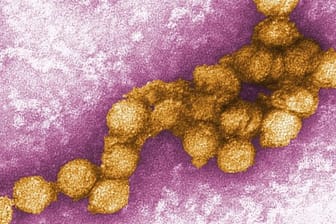 Das West-Nil-Virus unter dem Elektronenmikroskop.