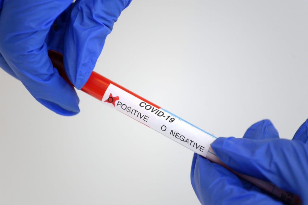 Ein positiver Corona-Test (Symbolbild): Bei einem Besuch in einem Neuköllner Brauhaus haben sich mehrere Menschen mit dem Coronavirus infiziert.