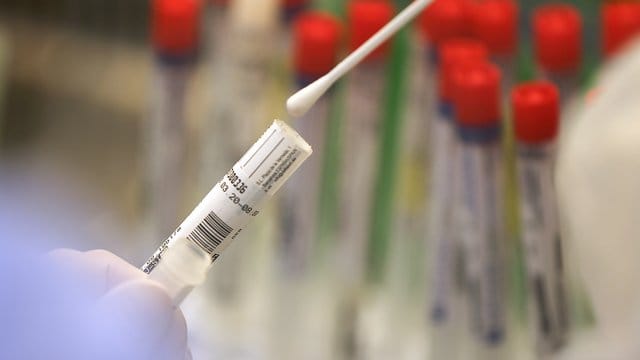Die Zahl der Neuinfektionen in Deutschland steigt weiter an. Die Zahl der Neuinfektionen in Deutschland steigt weiter an.