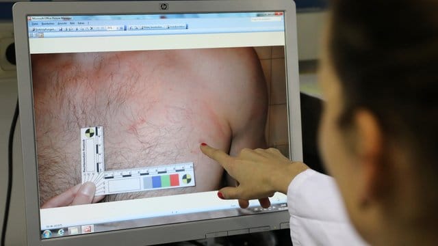 Im Untersuchungsraum der Opferambulanz am Institut für Rechtsmedizin zeigt eine Assistenzärztin den dokumentierten Fall einer Verletzung bei einem Mann. Im Untersuchungsraum der Opferambulanz am Institut für Rechtsmedizin zeigt eine Assistenzärztin den dokumentierten Fall einer Verletzung bei einem Mann.
