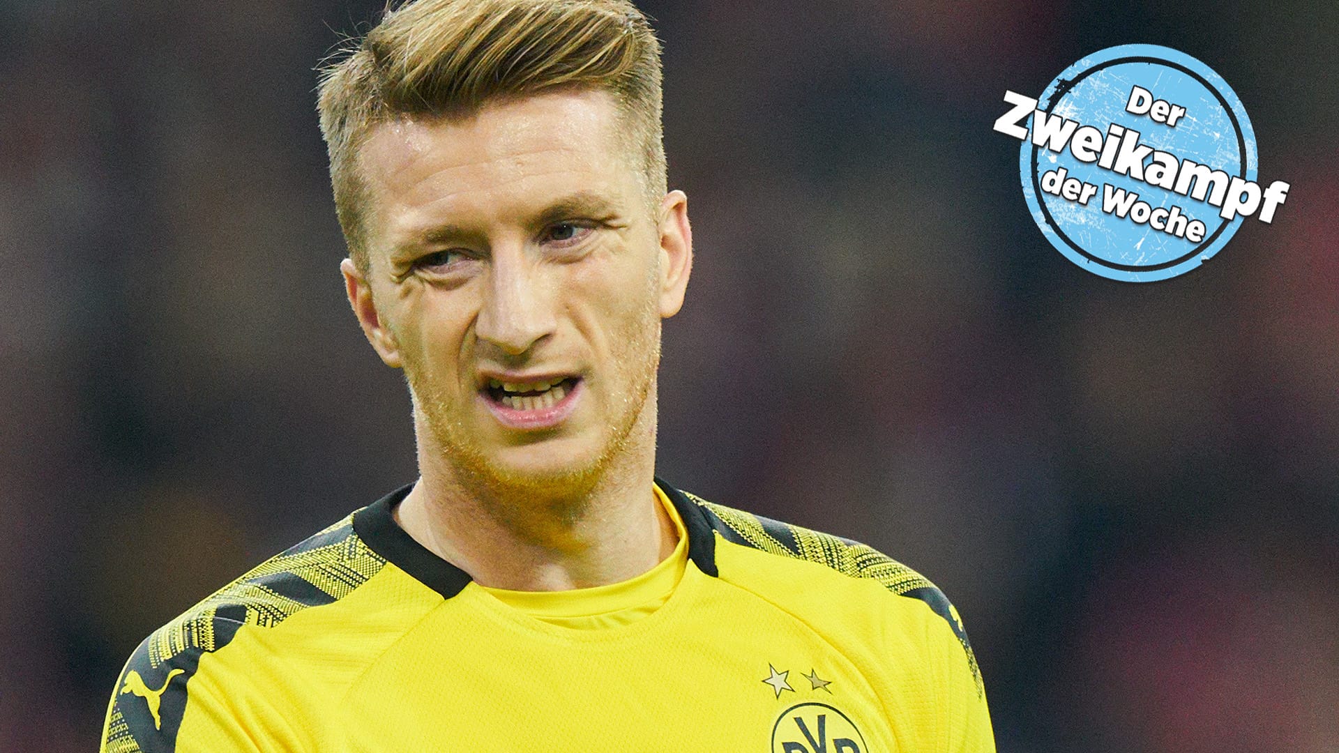 Seit 2012 hatte Marco Reus schon 22 Verletzungen. Seine neueste stoppt ihn wohl bis Jahresende.