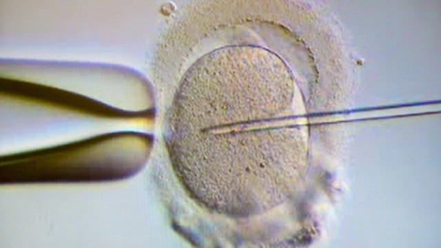 Ein Spermium wird einer Eizelle injiziert - auch als alleinstehende Frau kann man die Kosten für eine künstliche Befruchtung steuerlich absetzen. Ein Spermium wird einer Eizelle injiziert - auch als alleinstehende Frau kann man die Kosten für eine künstliche Befruchtung steuerlich absetzen.