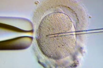 Ein Spermium wird einer Eizelle injiziert - auch als alleinstehende Frau kann man die Kosten für eine künstliche Befruchtung steuerlich absetzen.