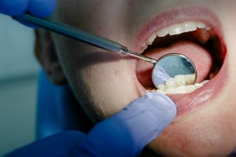 Keine Kontrolle wegen der Pandemie: Mehr als jeder Fünfte hat einer Umfrage zufolge aufgrund von Corona einen Zahnarztbesuch verschoben.