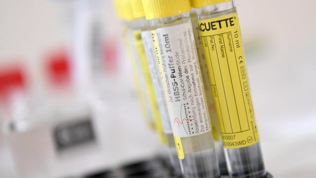 Pipetten mit Material für einen Gurgeltest.
