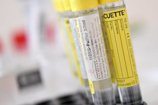 Pipetten mit Material für einen Gurgeltest.