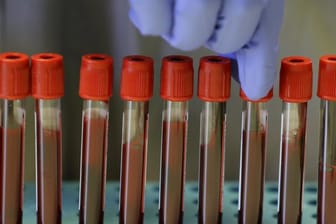 Blutproben von Freiwilligen in einem Labor.