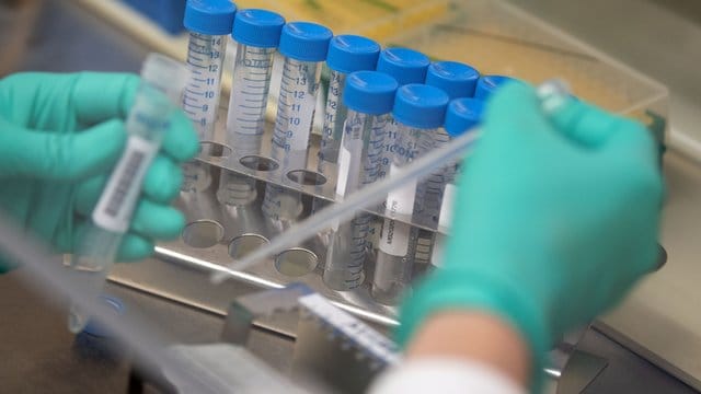 Bei vielen Infektionskrankheiten gilt: Hat ein Patient die Erkrankung hinter sich, ist er einige Zeit vor dem Erreger geschützt. Bei vielen Infektionskrankheiten gilt: Hat ein Patient die Erkrankung hinter sich, ist er einige Zeit vor dem Erreger geschützt.