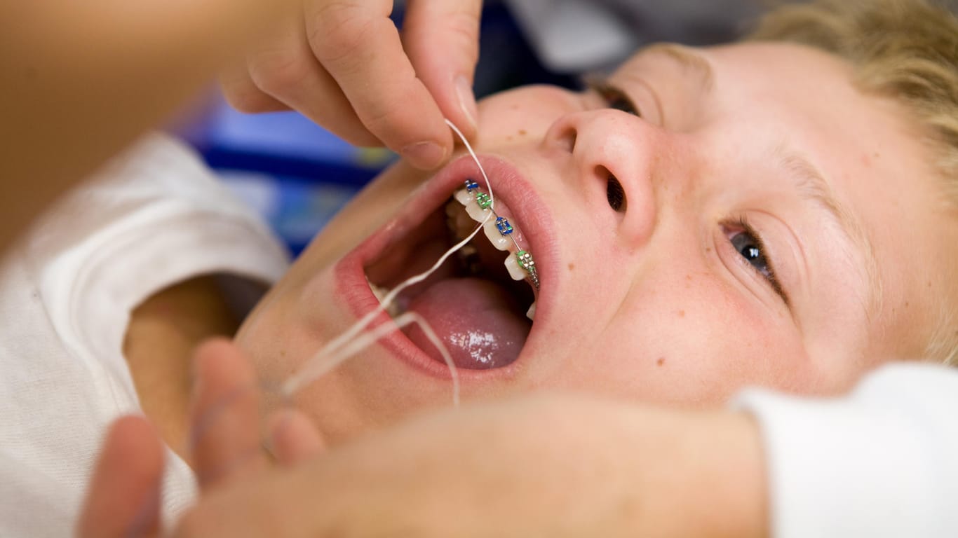 Ein Junge mit Zahnspange beim Zahnarzt (Archivbild): Wer über eine Zahnzusatzversicherung für seine Kinder nachdenkt, sollte darauf achten, dass sie auch für den Kieferorthopäden zahlt.
