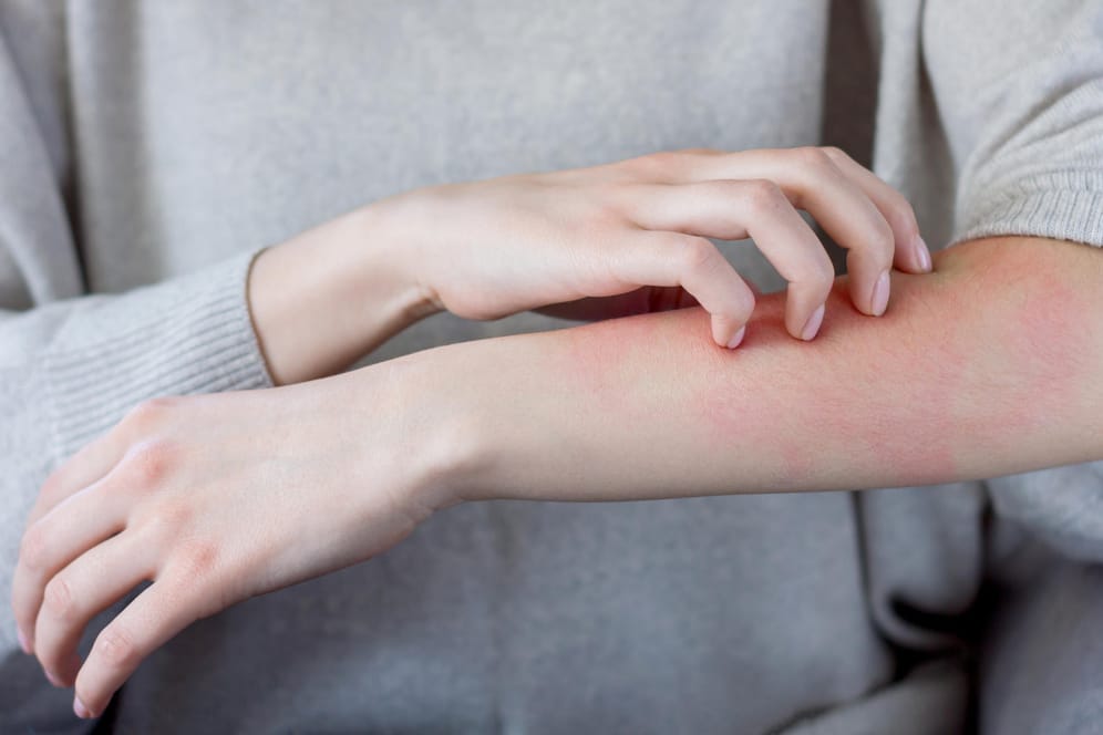 Hautausschlag: Hausstaub-Allergiker sollten ihre Bettwäsche regelmäßig reinigen.