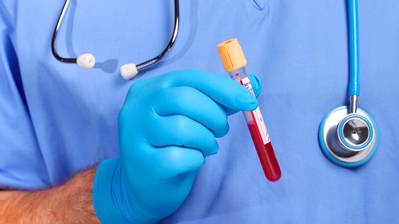 Ein Arzt hält ein Reagenzglas mit Blut: Ein Bluttest kann wichtige Hinweise auf eine Erkankung des Immunsystems geben.