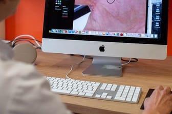 Eine Fachärztin für Dermatologie und Venerologie zeigt, wie die Behandlung von Patienten per Video funktioniert.