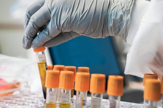 Laborunfall oder nicht: Über den Ursprung der Corona-Pandemie wird seit bald anderthalb Jahren spekuliert.