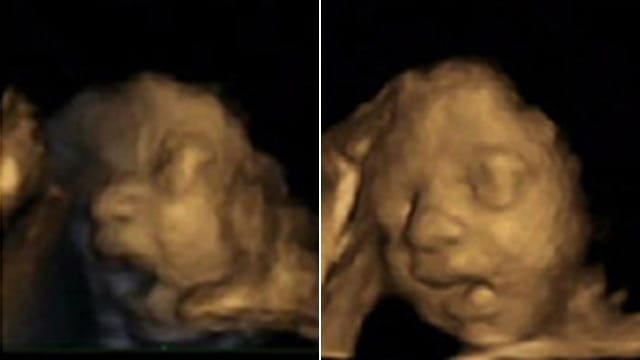 Warum gähnen Babys im Mutterleib? Warum gähnen Babys im Mutterleib?