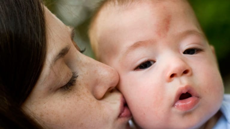 Storchenbiss beim Baby: Ein Storchenbiss, wie hier auf der Stirn des Babys, verschwindet meistens von selbst.