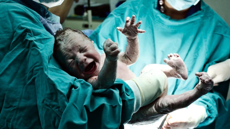 Frauenärzte raten zur Geburt in einem Krankenhaus (Symbolbild).