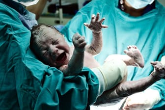 Frauenärzte raten zur Geburt in einem Krankenhaus (Symbolbild).