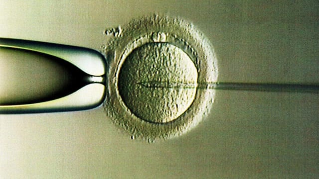 Mit einer feinen Nadel wird ein Spermium in eine Ezielle injiziert. Links im Bild die Pipette, die die Eizelle festhält. Mit einer feinen Nadel wird ein Spermium in eine Ezielle injiziert. Links im Bild die Pipette, die die Eizelle festhält.