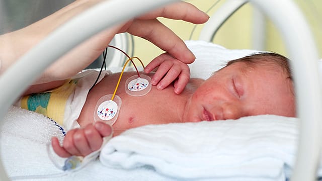 Nach einer Frühgeburt verbringen Eltern oft mehrere Monate bei ihren Babys auf der Intensivstation.