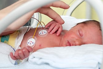 Nach einer Frühgeburt verbringen Eltern oft mehrere Monate bei ihren Babys auf der Intensivstation.