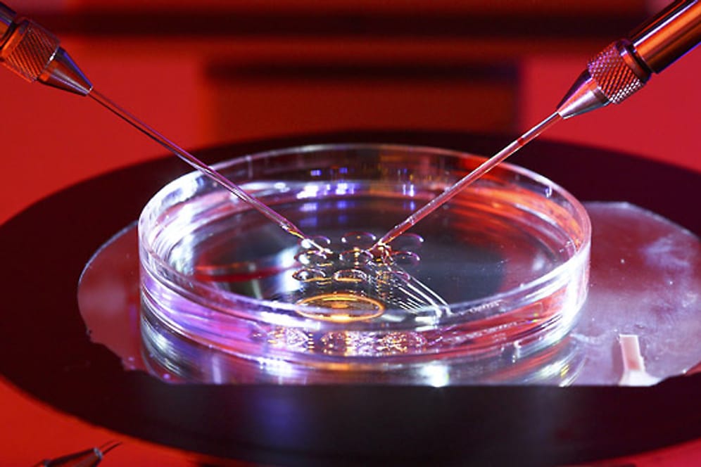 Künstliche Befruchtung: Unter einem Mikroskop werden Spermien des Vaters in eine Eizelle der Mutter injiziert.