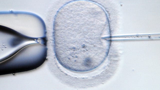 Beim pronuklearen Transfer - einer besonderen Form der künstlichen Befruchtung - kann aus zwei Müttern und einem Vater ein Embryo entstehen.