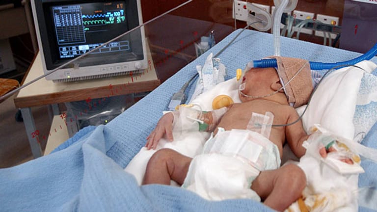 Sechs Tage altes Baby in den USA übersteht Herztransplantation