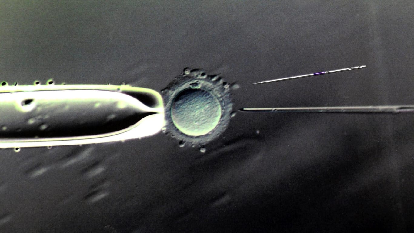 Künstliche Befruchtung: Eine Eizelle wird im Labor befruchtet.