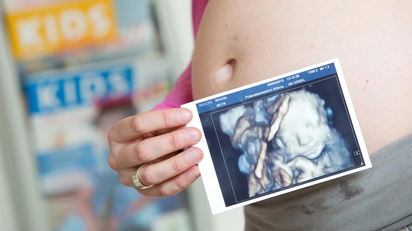 Dank hochauflösender Ultraschallbilder können Eltern bereits vor der Geburt erahnen, wie ihr Nachwuchs aussehen wird.