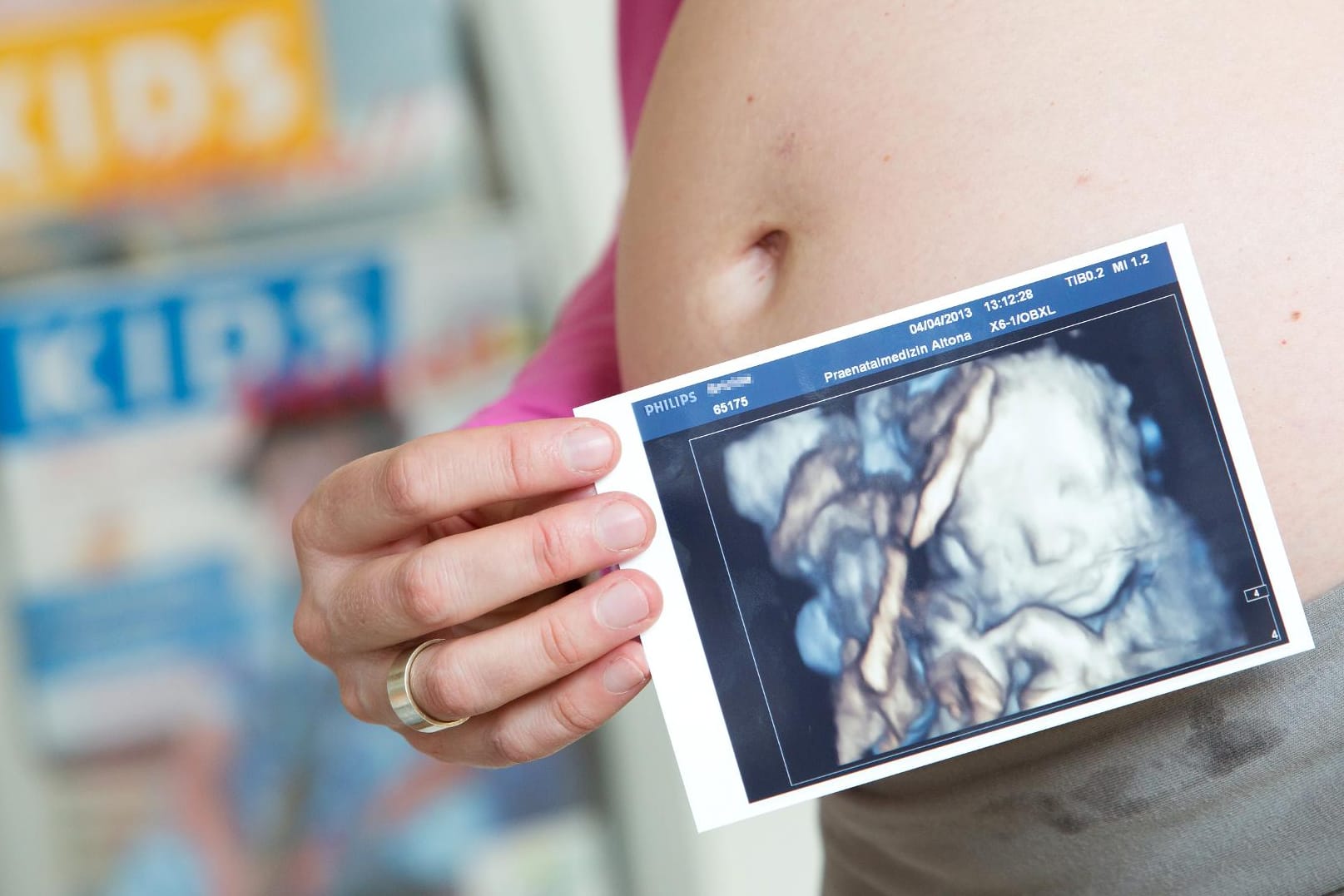 Dank hochauflösender Ultraschallbilder können Eltern bereits vor der Geburt erahnen, wie ihr Nachwuchs aussehen wird.