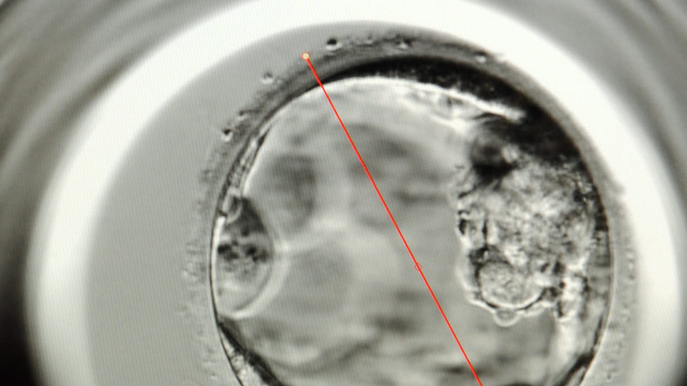 Auf dieser Aufnahme aus dem Kinderwunschzentrum Leipzig ist unter dem Mikroskop ein fünf Tage alter Embryo zu erkennen.