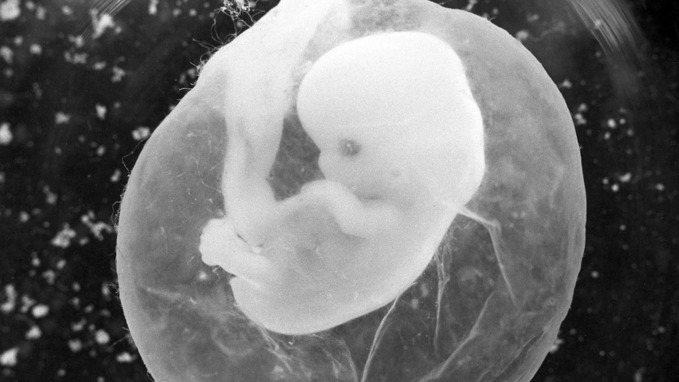 Das undatierte Foto zeigt einen sieben Wochen alten Fötus in einer Fruchtblase.